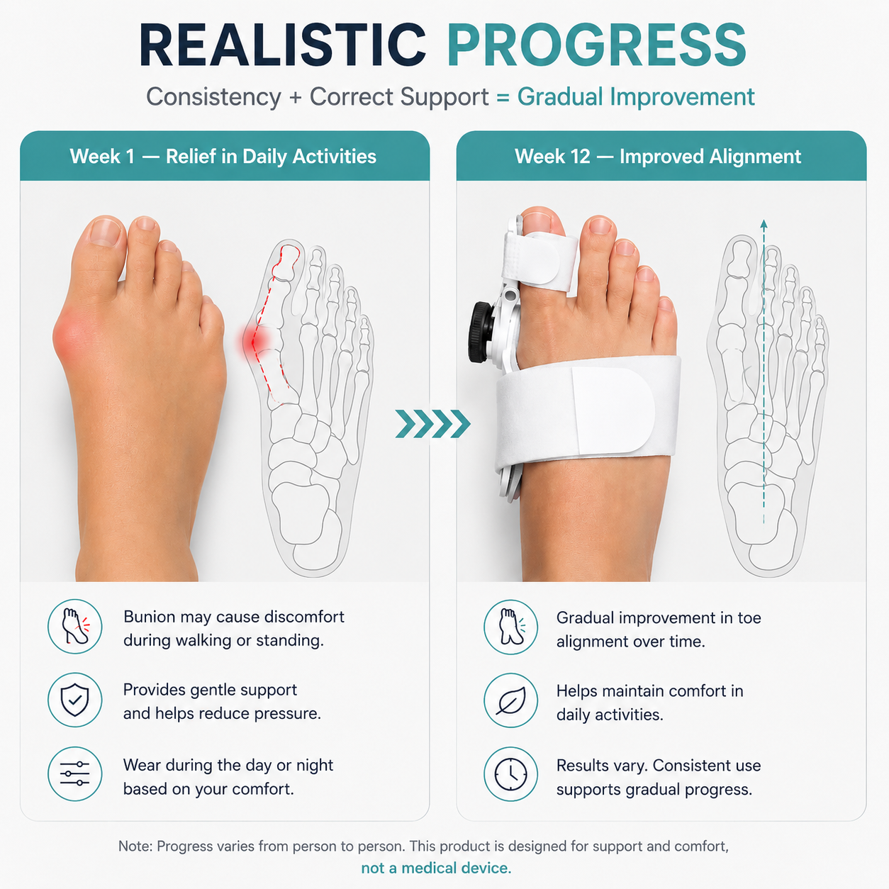Orthoza™ ToeAlign | Unisex Rotatable Finger Toe Adjustable Corrector